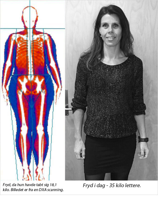Fryd - 35 kilo vægttab